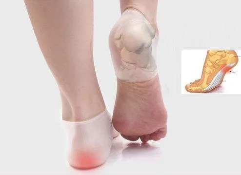 Heel Spur Relief - Plantar Fasciitis Gel Cup Massage Pads